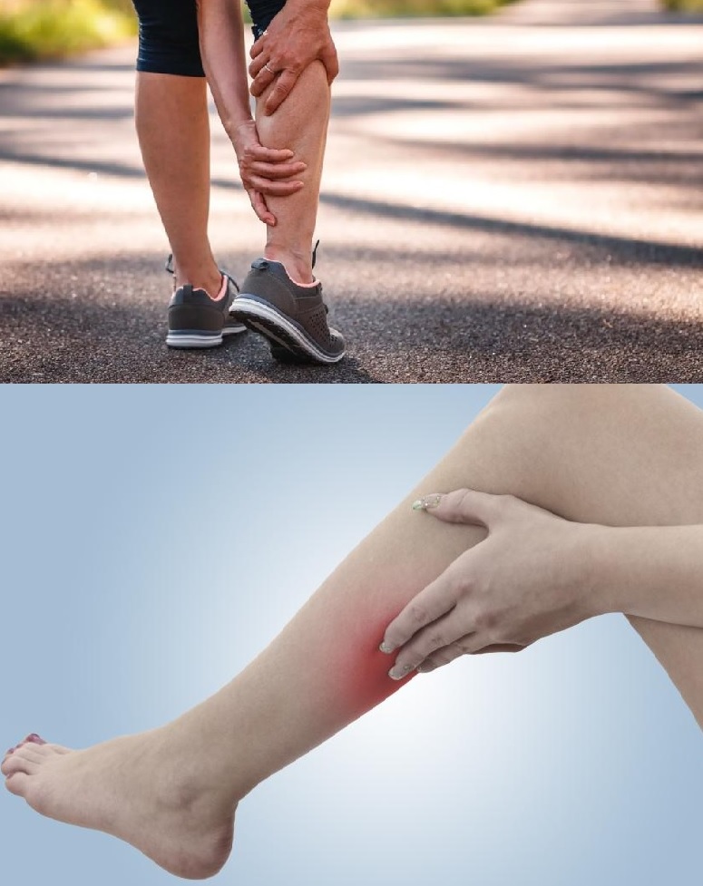 Cuáles son las cinco soluciones naturales para prevenir calambres