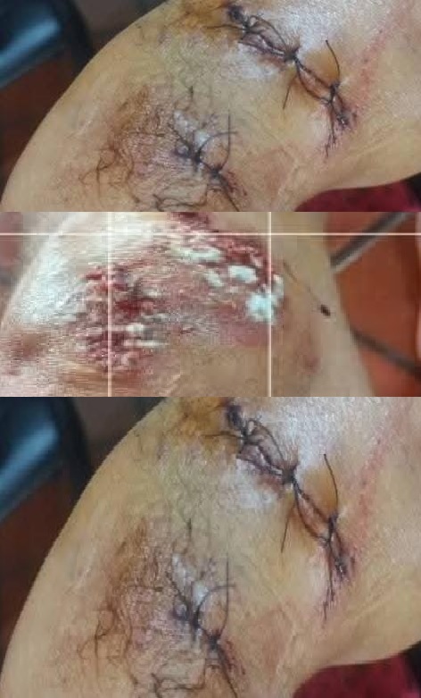 CATAMARCA: Violento hecho, un turista con heridas de consideración tras el ataque de un perro