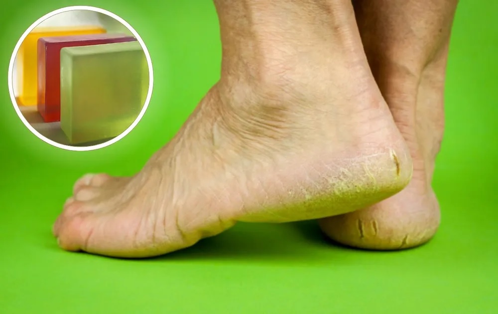 La glicerina es un beneficio para tus pies en verano