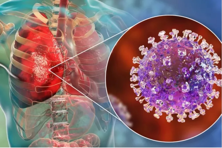 La OMS considera que es bajo el riesgo global de propagación del virus Nipah