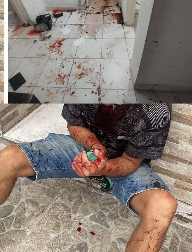 Violento ataque a machetazos contra un hombre en un estudio jurídico sobre avenida San Nicolás de Bari