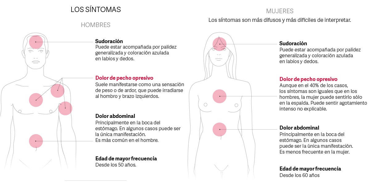 Cuál es la probabilidad de morir en un infarto y el nuevo método para salvarse en 10 segundos