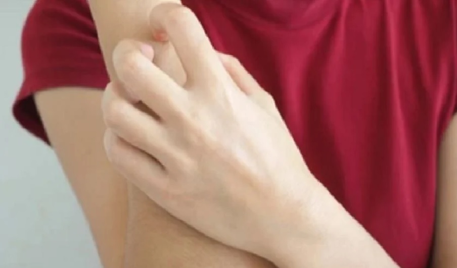 La enfermedad hereditaria que muchos confunden con alergia