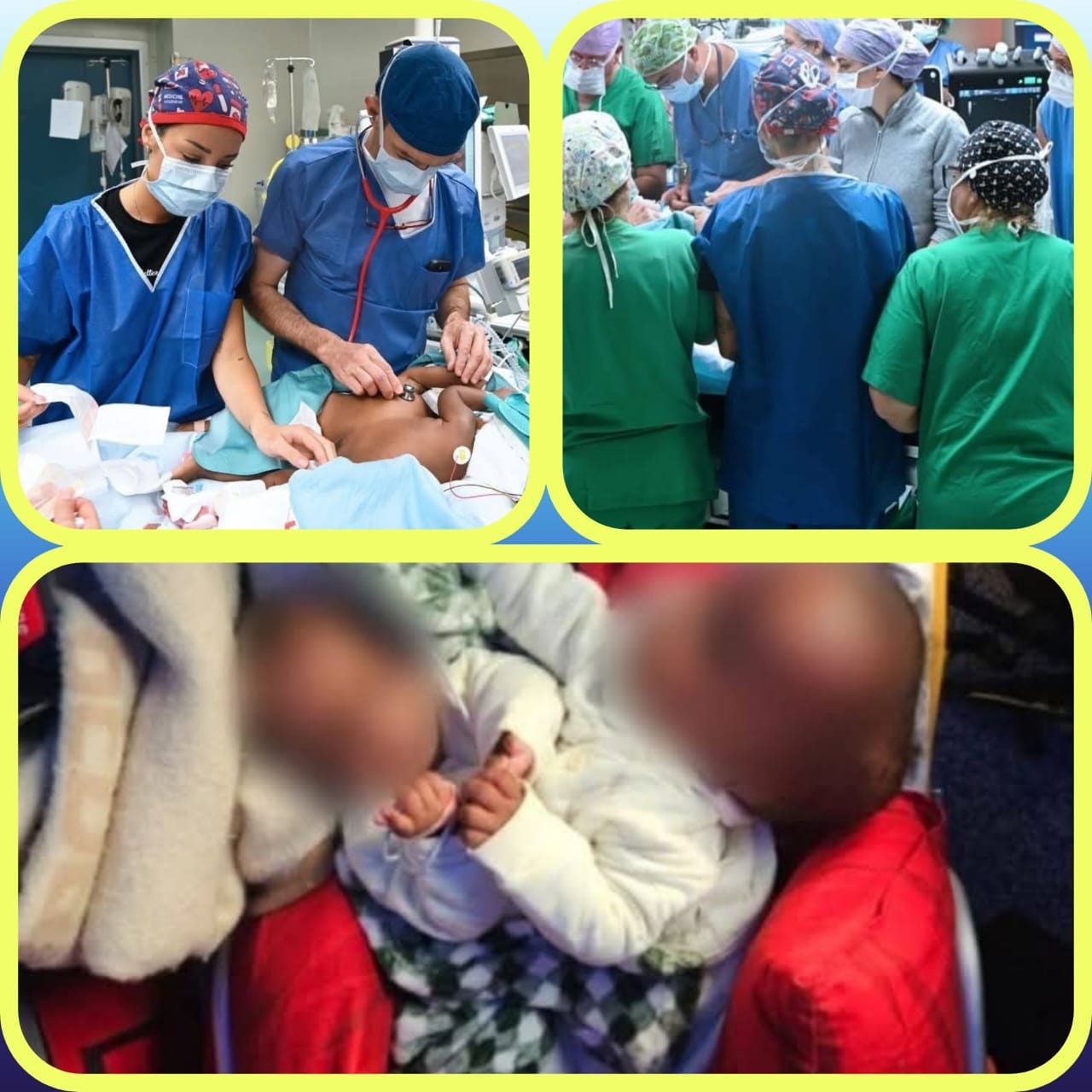 EL GARRAHAN: SEPARARON CON EXITO A DOS GEMELAS SIAMESAS DE ROSARIO. 50 CIRUJANOS Y 12 HS .UN MILAGRO!!!!  DE LOS QUE TRABAJAN CON CAPACIDAD SENSIBILIDAD Y AMOR PESE AL MALTRATO DE MILEI.